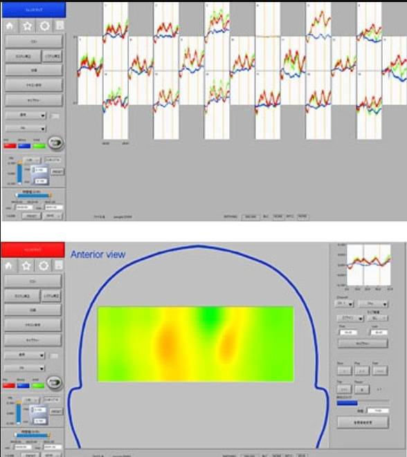研究型便携式近红外脑功能成像系统LIGHTNIRS